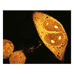 可见光阶段的瞬态吸收